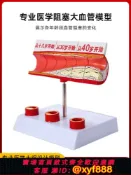 幸福時光館 {可打統編 保固一年}心腦血管堵塞模型關節血栓血液濃度脂肪病理粥樣硬化人體解剖教具