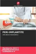 【三民網路書店】Peri-Implantite 作者：Manikhanta Akhil V.