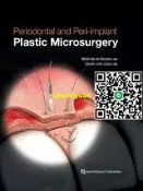 全彩 Periodontal and Peri-implant Plastic Microsurgery 現貨