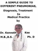 Kobo A Simple Guide To Different Pneumonias, Diagnosis, Treatment In Medical Practice