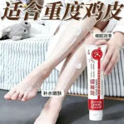 魚鱗雞皮疙瘩修護乳霜皮膚乾燥粗糙潤維生素 E 尿素身體素顏霜