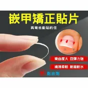 @貨比三家不吃虧@嵌甲矯正貼片 甲溝炎神器 嵌甲矯正器 凍甲貼片 指甲修護貼片 糾正指甲卷 無痕貼 正甲扣片 糾正肉包甲