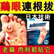 日本爆款 頑固雞眼 雞眼貼布 老繭 手繭 腳 肉刺  魚目貼 腳底雞眼肉刺 厚繭 軟化 腳趾貼 顆粒肉芽 草本植物