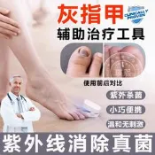 【可開發票】灰指甲治療儀紫外線雷射殺菌光療機清潔燈行動式護理輔助工具zg