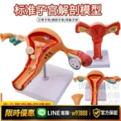 幸福時光館 {可打統編 保固一年}人體女性生殖子宮解剖病理模型 陰道卵巢教學模型 婦科生殖科教具