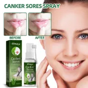 口腔潰瘍緩解噴霧治療 Canker 牙齦疼痛咽炎緩解口腔疼痛天然草本口腔抗菌噴霧