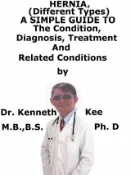 Kobo Hernia, (Different Types) A Simple Guide To The Condition, Diagnosis, Treatment And Related