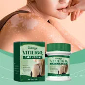  肌膚修護乳霜 30公克 – 含薄荷葉及蘆薈萃取物 – 快速吸收、不黏膩 – 均勻膚色、鎖水保濕