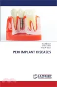 【三民網路書店】Peri Implant Diseases 作者：Syed Ibrahim