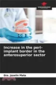 【三民網路書店】Increase in the peri-implant border in the anterosuperior sector 作者：Dra Joselin Mata